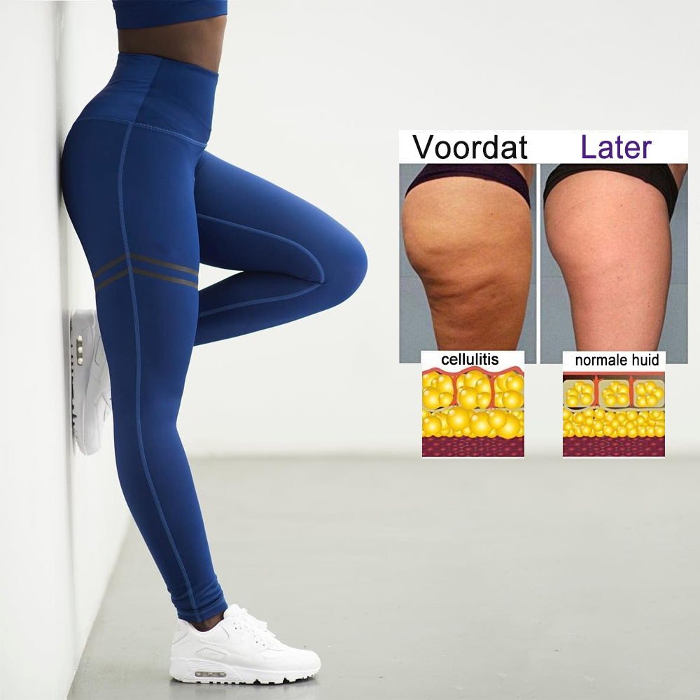 Kompressionsleggings für Damen - SculptFit Anti-Cellulite Frühjahr 2025 Edition